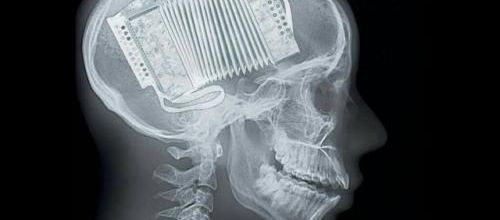 Attention, sortilège !