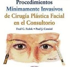 PROCEDIMIENTOS MINIMAMENTE INVASIVOS DE CIRUGIA PLASTICA FACIAL EN EL CONSULTORIO + VIDEOS ONLINE EBOOK | F. - CARNIOL, P. FEDOK | Descargar libro PDF EPUB