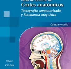 Libros descargables gratis para nook ATLAS DE BOLSILLO DE CORTES ANATÓMICOS TOMO 1 (4ª ED) TOMOGRAFÍA COMPUTARIZADA Y RESONANCIA MAGNÉTICA: CABEZA Y CUELLO de TORSTEN B. MÖLLER iBook FB2 RTF 9788