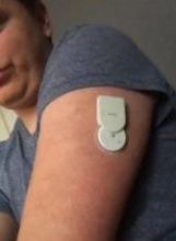 MIAO MIAO : UN LECTEUR PROMETTEUR POUR FREESTYLE LIBRE EN CGM.