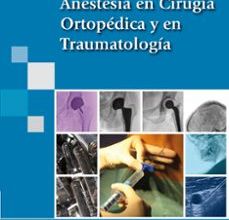 Descarga gratuita de libros de computadora ANESTESIA EN CIRUGIA ORTOPEDICA Y EN TRAUMATOLOGIA in Spanish FB2 MOBI PDB 9788498353211 de MISERICORDIA BASORA MACAYA, MARIA JOSE COLOMINA SOLER