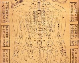 Histoire de l'acupuncture