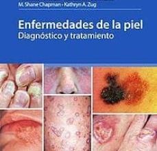 Leer libros electrónicos en línea ENFERMEDADES DE LA PIEL. DIAGNOSTICO Y TRATAMIENTO RTF PDF 9789874922212 (Spanish Edition) de 