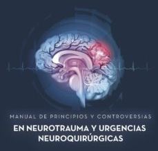 Descargar libros electrónicos google pdf MANUAL DE PRINCIPIOS Y CONTROVERSIAS EN NEUROTRAUMA Y URGENCIAS NEUROQUIRURGICAS