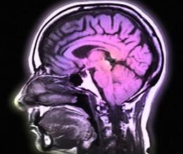 effets secondaires d'antipsychotiques sur le cerveau