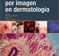 Libros de Kindle descargan rapidshare DIAGNÓSTICO POR IMAGEN EN DERMATOLOGIA de M. R. HAMBLIN 9788491131762 DJVU PDB en español