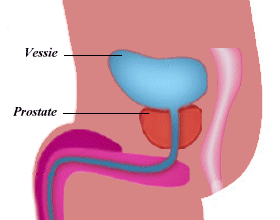HORMONES, PROSTATITES ET CALVITIES