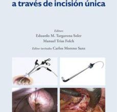 Descargar Ebook for tally erp 9 gratis CIRUGÍA LAPAROSCÓPICA A TRAVÉS DE INCISIÓN ÚNICA in Spanish 9788415340157 PDB RTF FB2 de EDUARDO M. TARGARONA SOLER