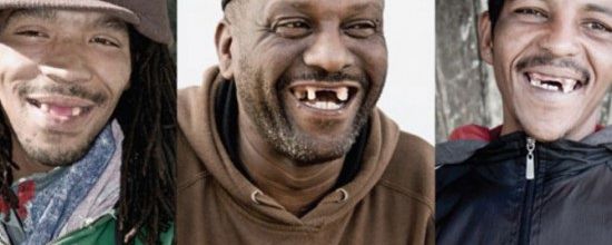 La nouvelle tendance en Afrique du Sud ? Ne plus avoir de dents de devant