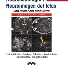 Descargar gratis ebooks en formato pdf gratis NEUROSONOLOGÍA Y NEUROIMAGEN DEL ICTUS. UNA REFERENCIA EXHAUSTIVA + ACCESO A CONTENIDOS ONLINE (2ª ED.) de R. &amp; KLINGEBIEL 9789804300165 (Litera