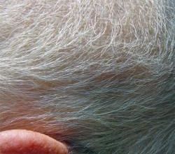 Mes cheveux repoussent - My hair grows up again.
