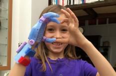 e-Nable, une association qui fournit gratuitement des prothèses de mains aux personnes présentant une agénésie