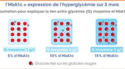 Son Suivre son diabète