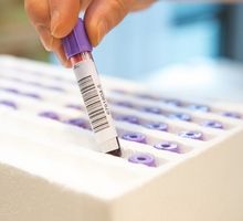 Analyse des apolipoprotéines