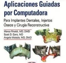 {epub descargar} APLICACIONES GUIADAS POR COMPUTADORA. PARA IMPLANTES DENTALES, INJERTOS ÓSEOS Y CIRUGÍA RECONSTRUCTIVA + VIDEOS ONLINE