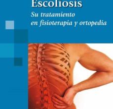 [Descargar pdf] ESCOLIOSIS, SU TRATAMIENTO EN FISIOTERAPIA Y ORTOPEDIA