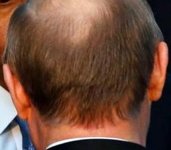 Poutine perd ses cheveux