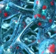 des cellules souches nerveuses contre Parkinson