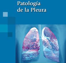 [Kindle] PATOLOGÍA DE LA PLEURA descargar gratis