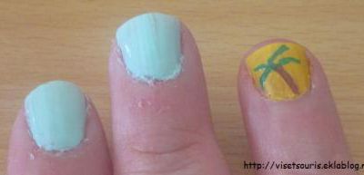 Des ongles au soleil