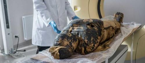 Un fœtus dans une momie