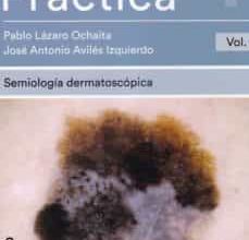 Ebook descargas de libros de texto gratis DERMATOSCOPIA PRÁCTICA VOL. 1 iBook 9788417089399 en español