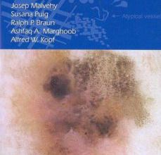 Amazon descarga audiolibros MANUAL DE DERMATOSCOPIA de J. MALVEHY