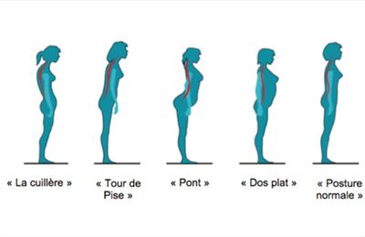  Des femmes en mauvaises postures