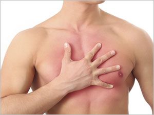 Diagnostic de l'infarctus du myocarde.