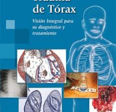 [Kindle] TRAUMA DE TÓRAX descargar gratis