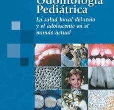 ODONTOLOGIA PEDIATRICA: LA SALUD BUCAL DEL NIÑO Y EL ADOLESCENTE EN EL MUNDO ACTUAL ePub gratis