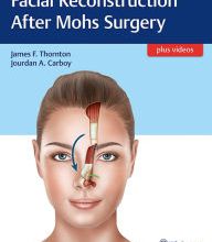Free ebooks download german Facial Reconstruction After Mohs Surgery 9781626237346 by James Thornton DJVU