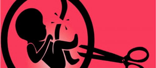 Jenis Aborsi Kandungan Melalui Dokter