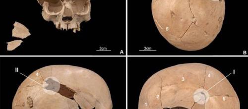 Des archéologues élucident le meurtre de neuf personnes 7 300 ans après